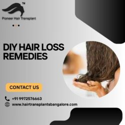 DIY Hair Loss Remedies vs. Professional Treatments