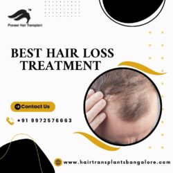 Best Hair Loss Treatment in Bangalore- Hair Transplant Treatment