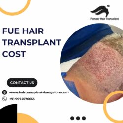 Best FUE Hair Transplant in Bangalore | FUE Hair Transplant Cost