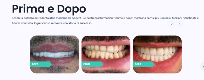 Impianti Dentali in Albania con Andent – Qualità, Sicurezza e Convenienza