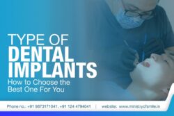 Best Dental Implant Experience in Gurgaon