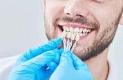 Dental implants alfred cove