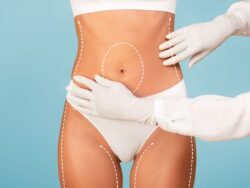 Body Positivity and Choosing a Tummy Tuck