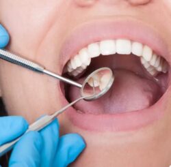 Dentist St Marys NSW