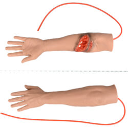 Laceration & Fracture Wound Packing Arm Trainer Kit
