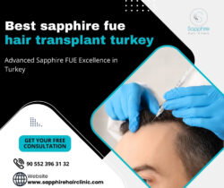 Best Sapphire FUE Hair Transplant Turkey for Natural Results