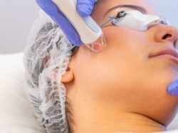 Is Fractional CO2 Laser Cost Dubai the Key to Clear, Bright Skin Effortlessly