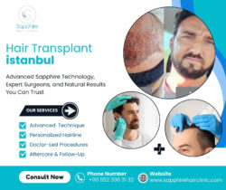 Hair Transplant Istanbul – Restore Your Hair with Confidence