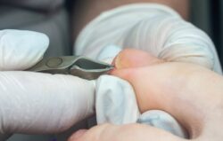 Medical Pedicure Canberra