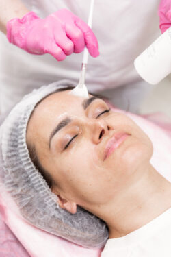Can Glycolic Acid Peel Treatment Improve Skin Barrier Appearance?