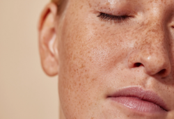 How Does Melasma Care Help Improve Skin Texture?