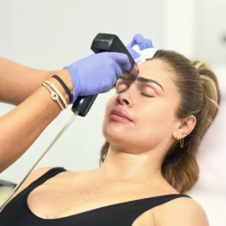 Can Morpheus8 Maintain Healthy And Youthful Skin Over Time?