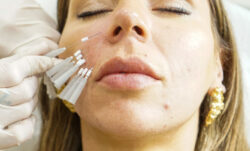 Can PDO Mono Threads Reduce the Signs of Aging?