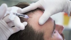 Do G Cell Hair Treatments Improve Hair Density?