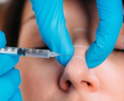 Does Non-Surgical Rhinoplasty Look Natural?