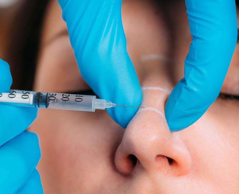 Does Non-Surgical Rhinoplasty Look Natural?