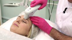 Does Pico Laser Treatment Give Precise Skin Resurfacing Results?