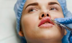 How Do Lip Fillers Enhance Lip Color and Appearance