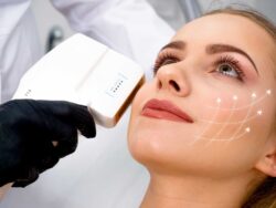 How Does HIFU Treatment Restore Skin Tightness Over Time?