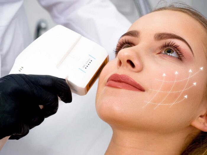 How Does HIFU Treatment Restore Skin Tightness Over Time?