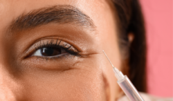 How Does Under-Eye Filler Support Natural Eye Contours?