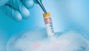 The IUI Process in Melbourne Made Simple and Stress-Free