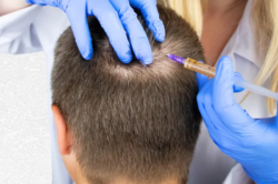 Is GFC Treatment For Hair Effective On Fine Or Fragile Hair