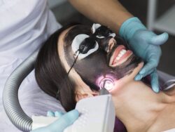 Is Laser Carbon Peel Safe for First-Time Skin Treatments?