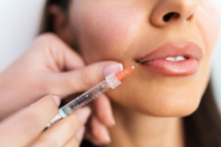 Is Lip Filler a Popular Choice for Lip Enhancement?