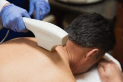 Laser Hair Removal and Sun Exposure: What You Should Know