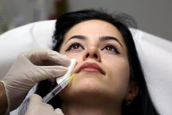 How Do Restylane Fillers Improve Lip Shape and Volume?