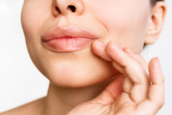 Can Pink Lips Laser Treatment Reveal Soft, Youthful Lips Without Harsh Treatments