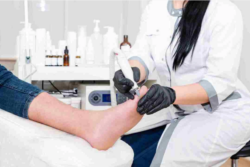 Ingrown Toenail Canberra