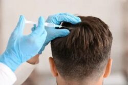 What Hair Problems Can GFC Treatment Address?