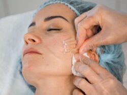What Makes PDO Mono Threads Improve Skin Gradually Over Time?