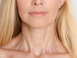 Which Areas of the Face See Most Change With Nefertiti Lift?