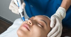 Why Do People Choose Dermapen Microneedling for Glowing Skin?