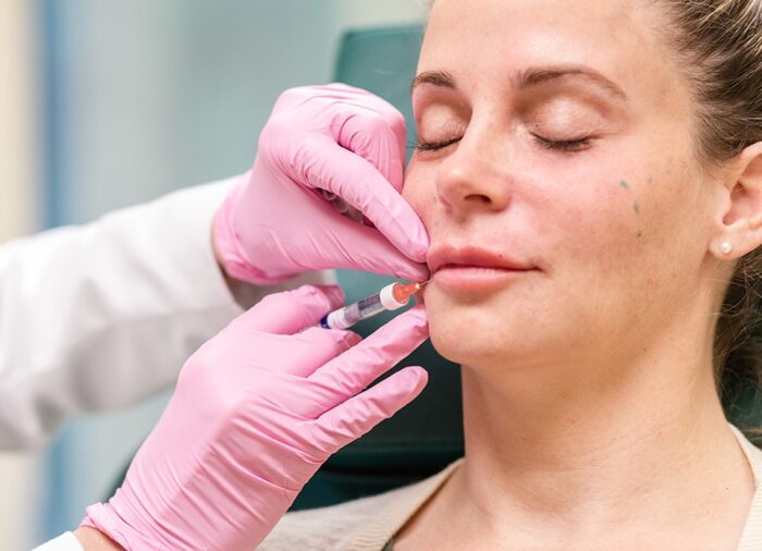 Can Best Lip Fillers Injection Fix Thin Lip Appearance?