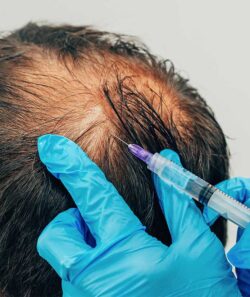 Can G Cell Hair Treatment Be Considered a Natural Procedure?