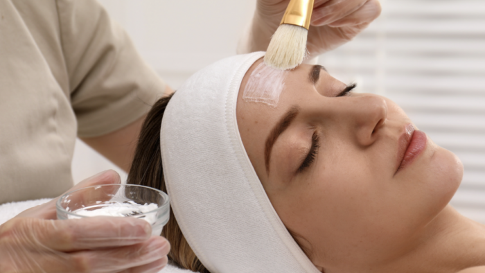 Can Glycolic Acid Peel Treatment Reduce Fine Lines Naturally?