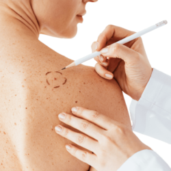 Can Skin Tag Removal Improve Comfort From Skin Lumps and Tags?