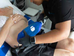 CoolSculpting for Abdomen: A Complete Overview