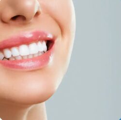 Teeth Whitening Penrith