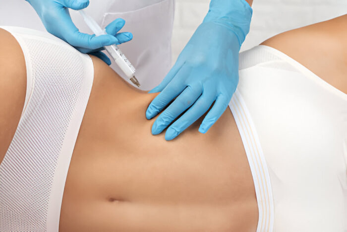 Does body filler treatment improve skin texture?