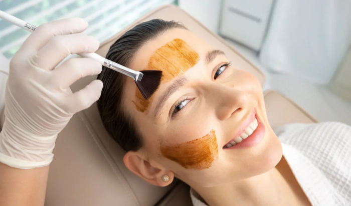 How Can Cosmelan Peel Reduce Skin Discoloration?