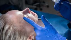 How Dimple Creation Enhances Your Smile