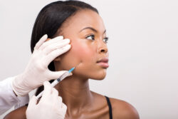 How Do Face Fillers Restore Lost Facial Volume?