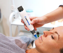 How Does Dermapen Microneedling Refine Skin Surface?