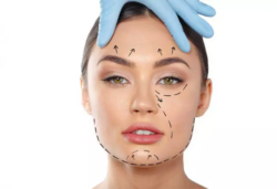 How Does Endolift Tighten Loose Skin Around Eyes?