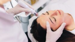 How does Pico Laser improve acne scar treatments?